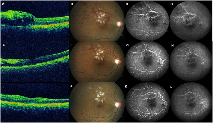 Fig 1