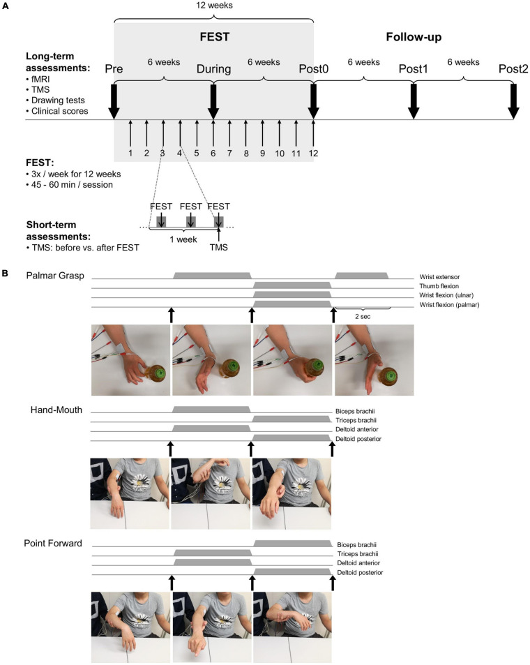 FIGURE 1