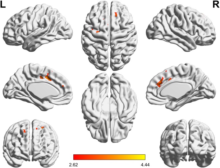 Figure 4