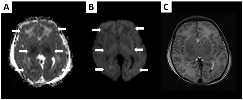 FIGURE 3