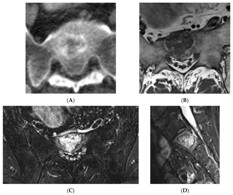 Figure 11