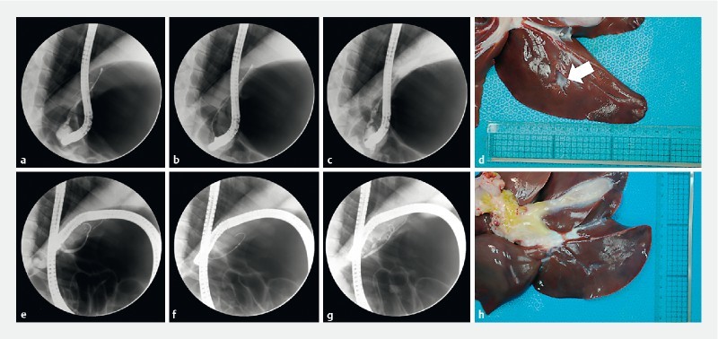 Fig. 1