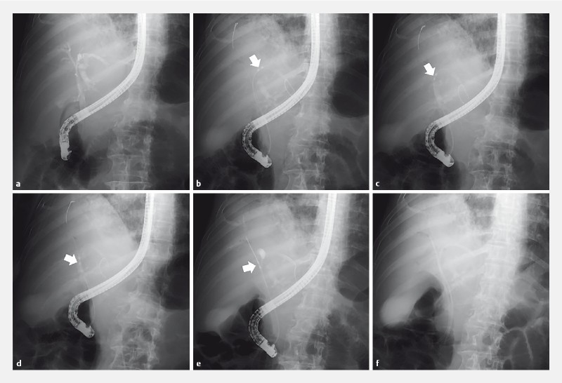 Fig. 3