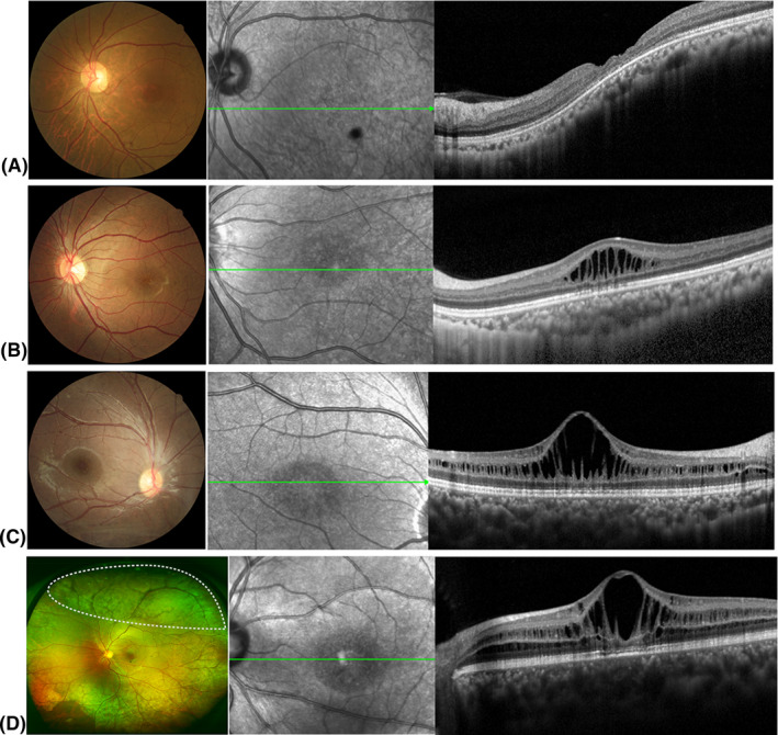 Fig. 2