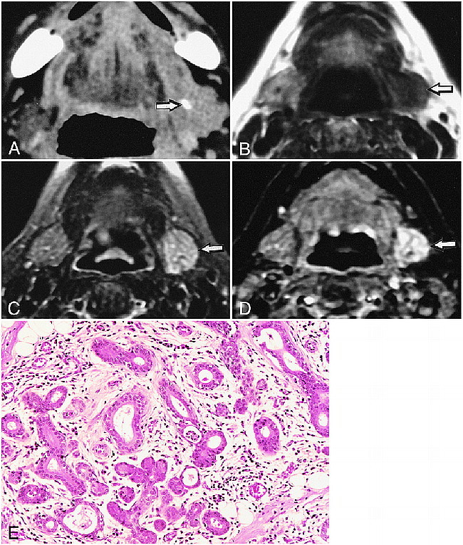 fig 1.