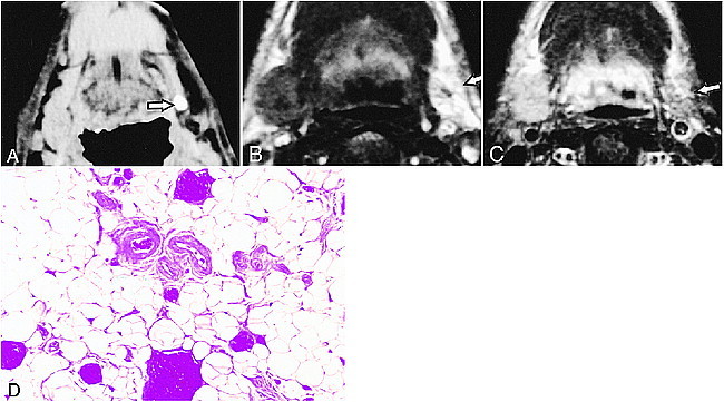 fig 4.