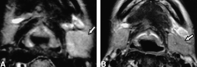 fig 3.