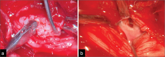 Figure 2: