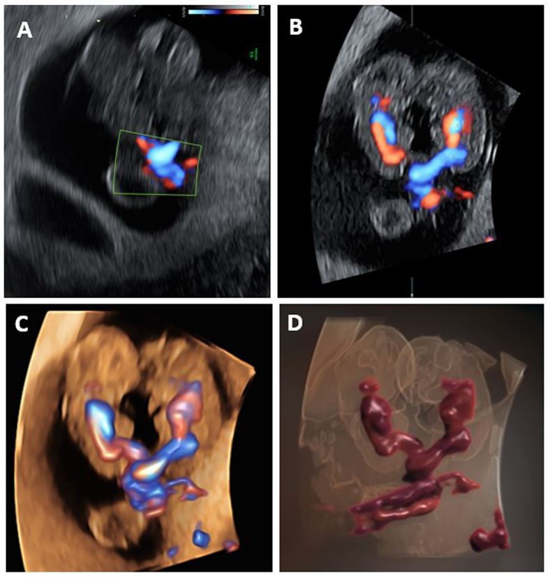 Fig. 2