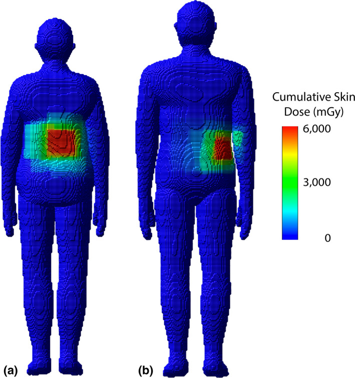 Figure 14