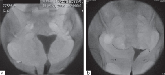 Figure 4 (a and b)