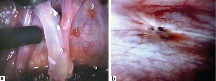 Figure 11 (a and b)