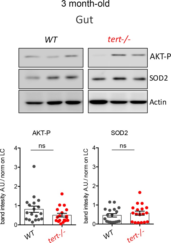 Figure 4—figure supplement 2.