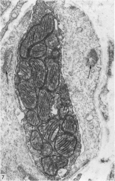 Fig. 7