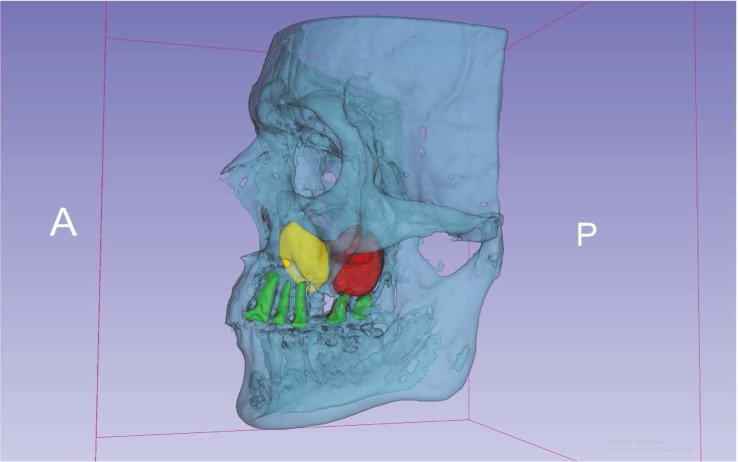 Fig. 2