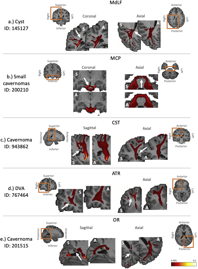 Fig. 11