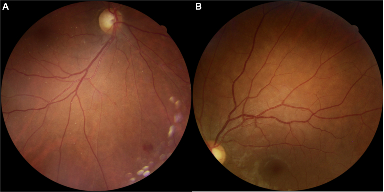 Figure 3