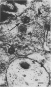91