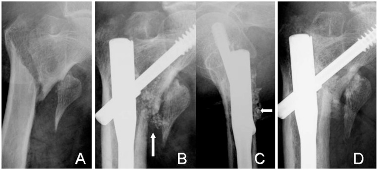 Fig. (6)