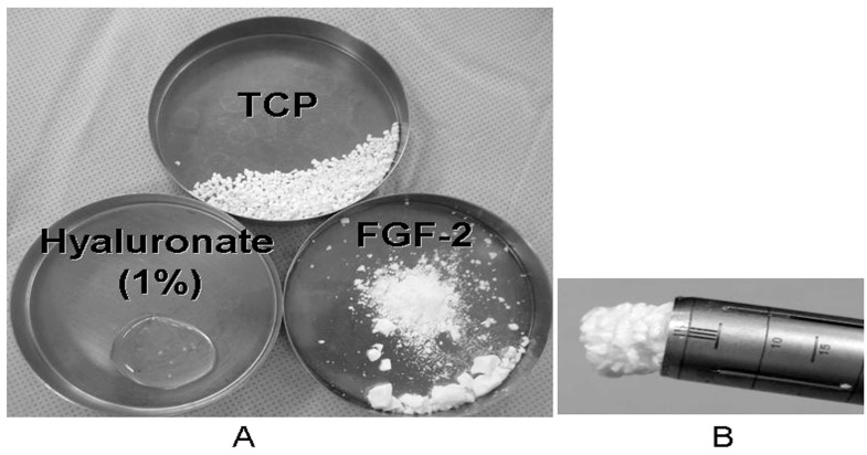 Fig. (1)