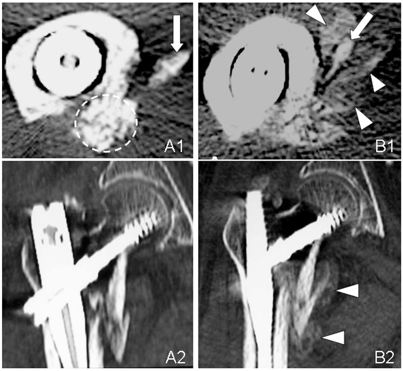 Fig. (4)