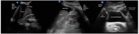Fig 1 –