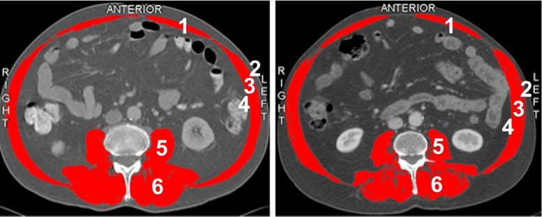 Fig. 1