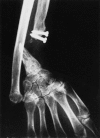 Fig. 2.