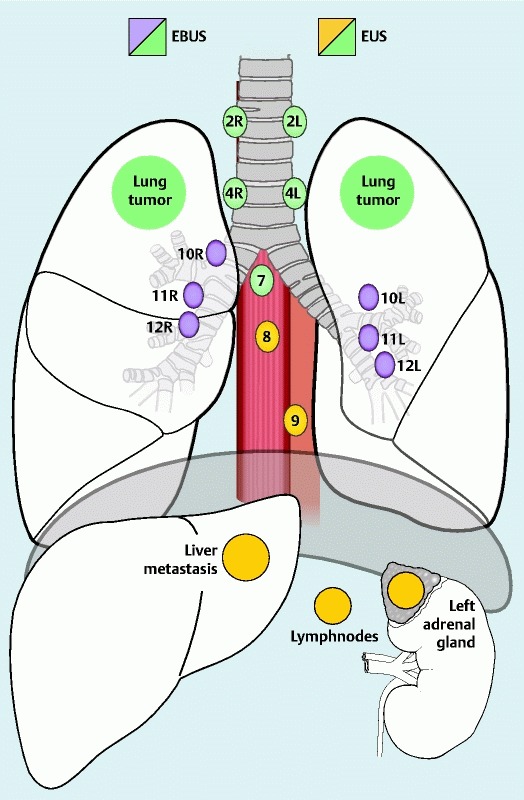 Fig. 1