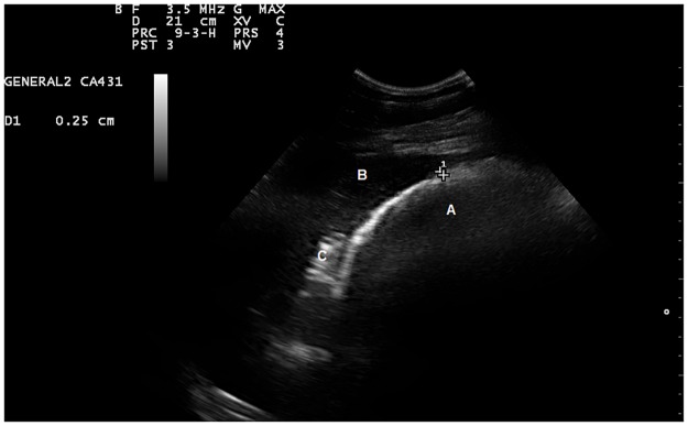 Fig 2