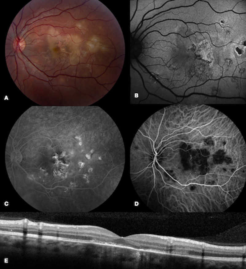 Fig 3