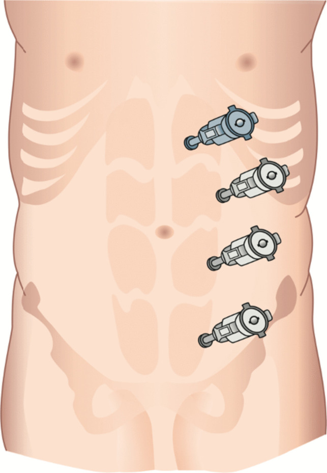 Fig. 4