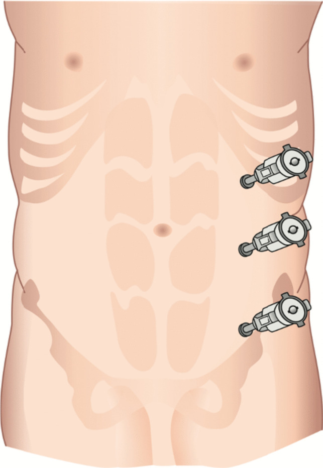 Fig. 3