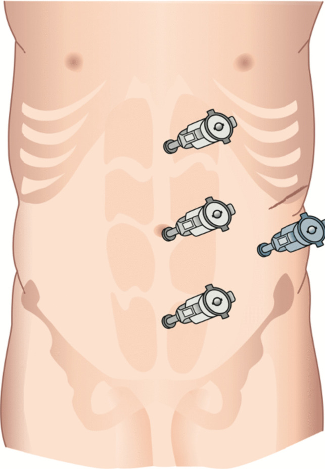 Fig. 5