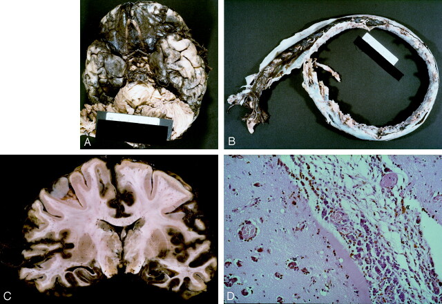 Fig 2.