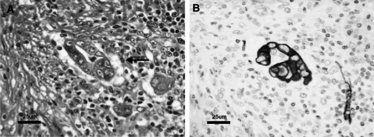 Fig. 14