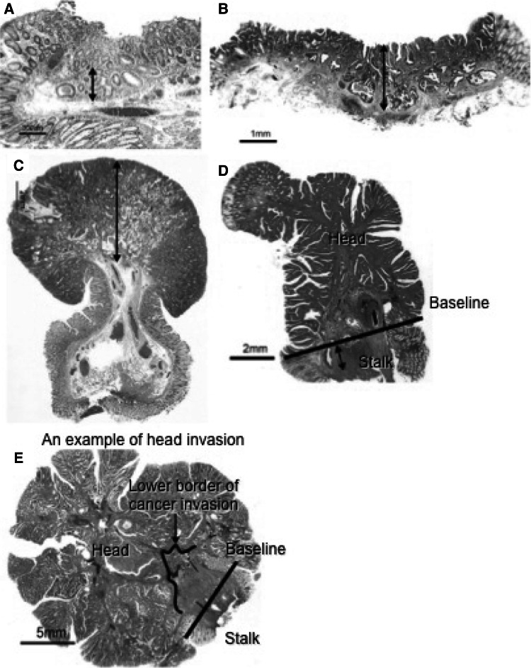 Fig. 11