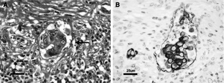 Fig. 13