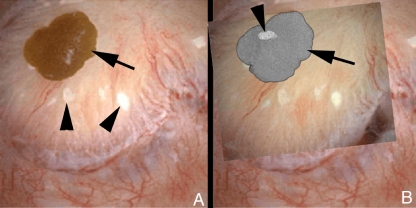 Fig. 4