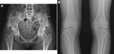 Fig. 18