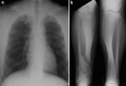 Fig. 13
