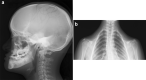 Fig. 17