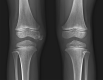 Fig. 20