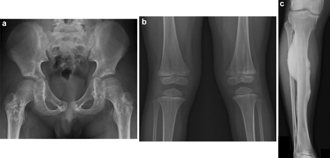 Fig. 12