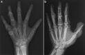 Fig. 21