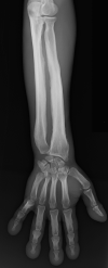 Fig. 15