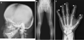 Fig. 11