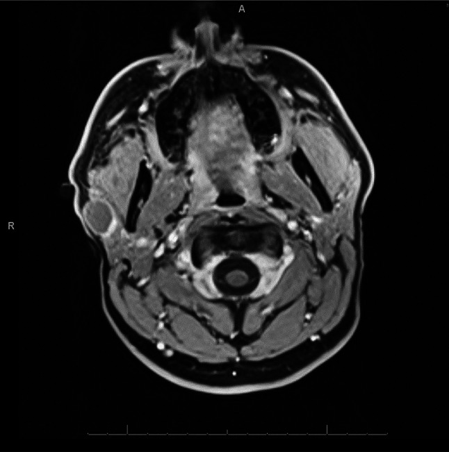 Fig. 1