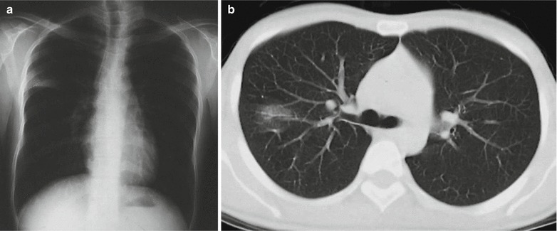 Fig. 20.11