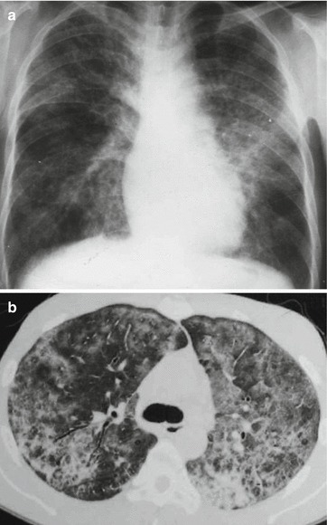 Fig. 20.36